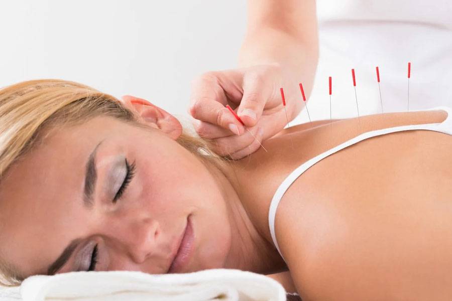 dry needling 2